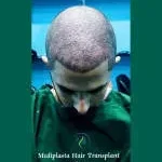 Mediplasta Hair Transplant & Aesthetic Clinic company icon